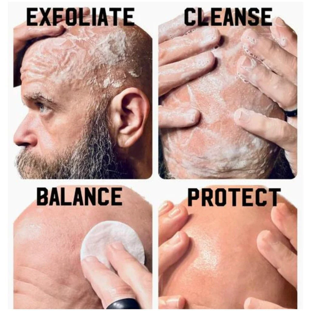 The Complete Bald Head Care System - Image 3