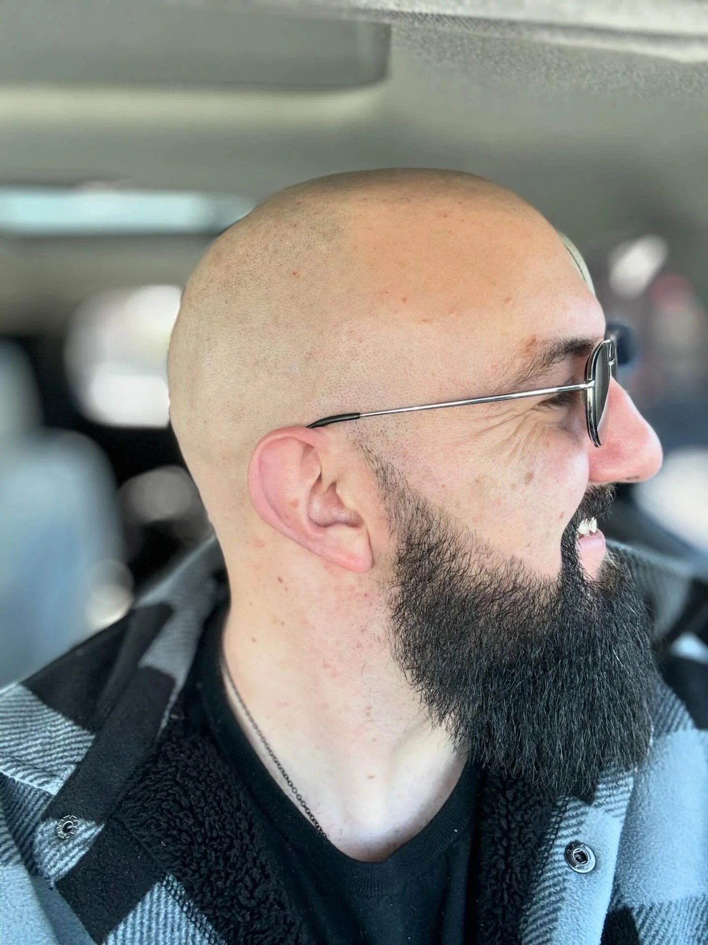 The Bald and Bearded Kit - Image 4